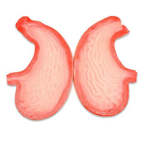 Модель «Желудок человека» Модель «Желудок человека»